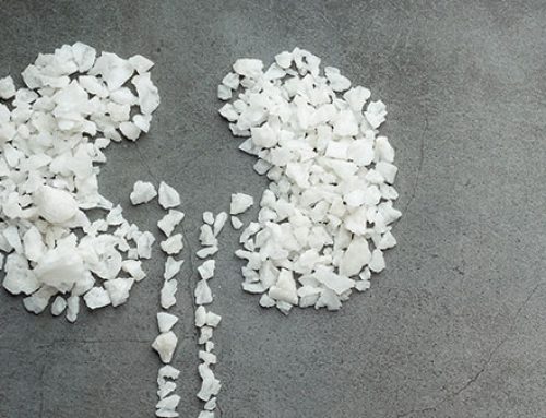 Zout en natrium: wat je moet weten voor een gezonde levensstijl